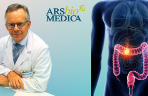 Colonscopia A Roma In Arsbiomedica
